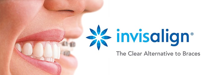 invisalign